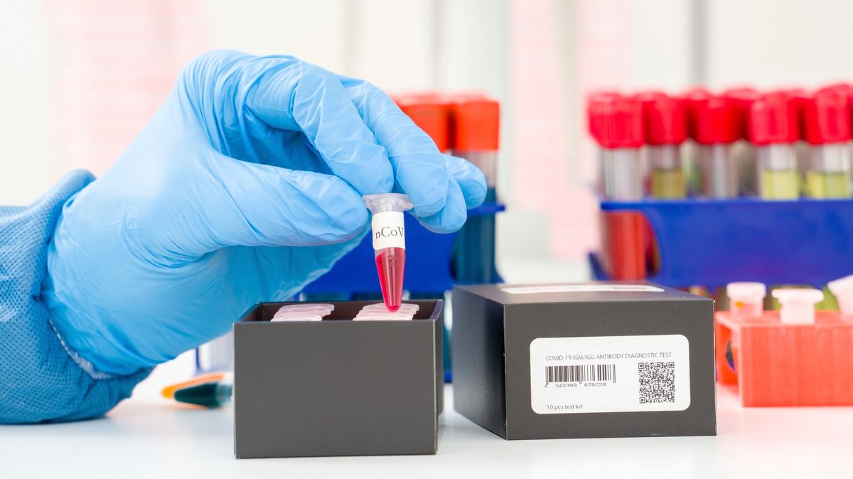 Zájem o testy protilátek je enormní, neuznávání je nefér, zní z laboratoře